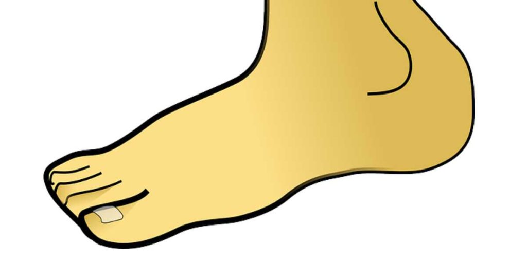 Foot and Ankle Rheumatoid Arthritis Symptoms