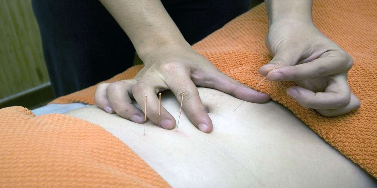 Acupuncture Therapy for Diabetes