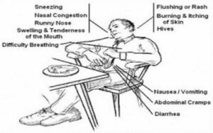 Allergy Development