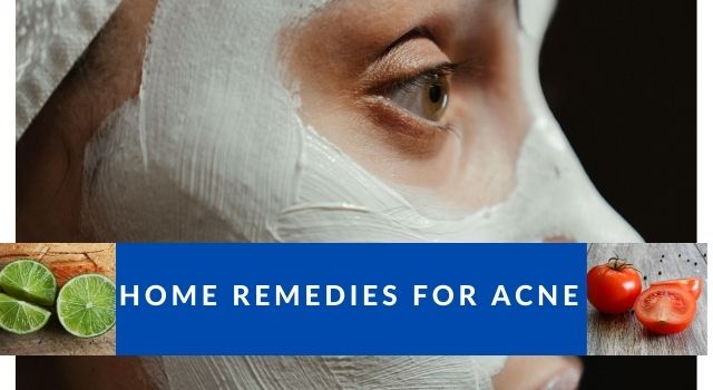 Home Remedies For Acne